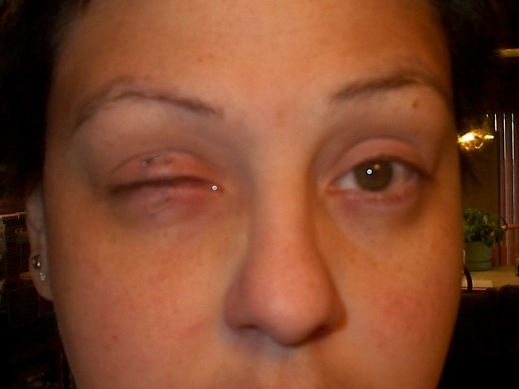 Stitched Her Eye Shut! Creepy! Photo by plaiyne_jaiyne Photobucket